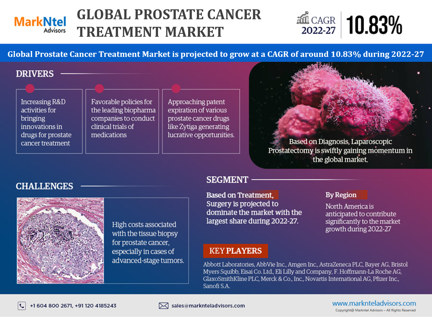 Global Prostate Cancer Treatment Market